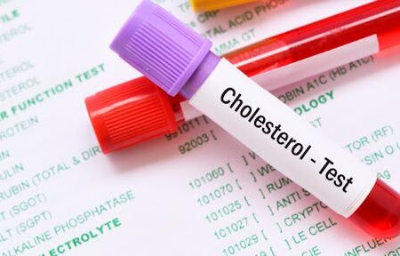 کلسترول و تری گلیسیرید چه فرقی باهم دارند؟